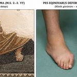 1800 yıllık Zeugma mozaiğinde tıbbi iz