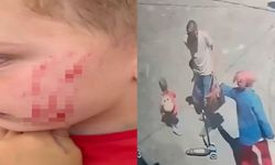 Sokakta oynayan 4 yaşındaki çocuğa saldırı