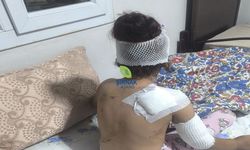 Başıboş köpekler 8 yaşındaki çocuğa saldırdı