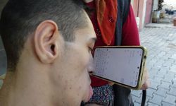 Engelleri burnuyla aştı telefonuyla hayata tutundu