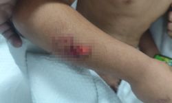 Köpek saldırısına uğrayan çocuk yaralandı