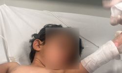 Elektrik Kesintileriyle Gündeme Gelen Kumçatı’da 3 Yaşındaki Çocuk Yaralandı