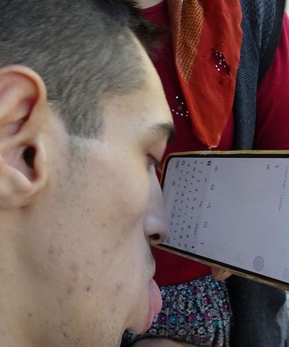 Engelleri burnuyla aştı telefonuyla hayata tutundu