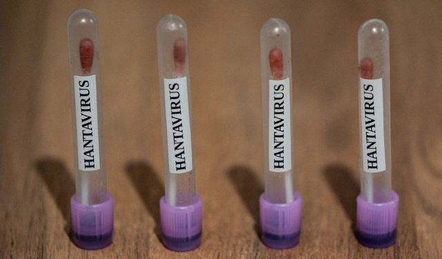 Türkiye'ye gelen yolcuların hantavirüs sonuçları açıklandı
