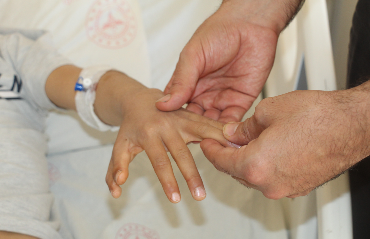 Yapışık Parmaklar